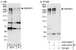 ANKHD1 Polyclonal Antibody
