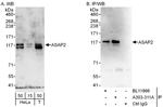 ASAP2 Antibody in Western Blot (WB)