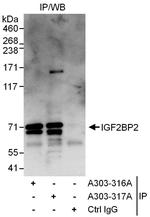 IGF2BP2 Antibody in Immunoprecipitation (IP)