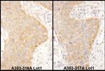 IGF2BP2 Polyclonal Antibody