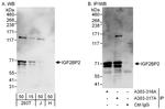 IGF2BP2 Antibody in Western Blot (WB)