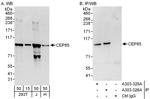CEP85 Antibody in Western Blot (WB)