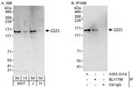 ZZZ3 Polyclonal Antibody