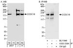 CCDC18 Polyclonal Antibody