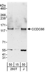 CCDC66 Polyclonal Antibody