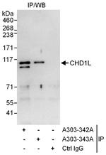 CHD1L Polyclonal Antibody
