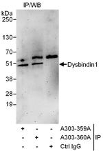 Dysbindin1 Antibody in Immunoprecipitation (IP)