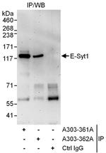 E-Syt1 Polyclonal Antibody