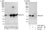 Exo70 Polyclonal Antibody