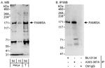 FAM65A Antibody in Western Blot (WB)