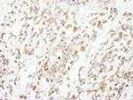 Cul1 Polyclonal Antibody