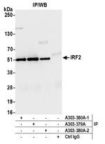 IRF2 Antibody in Immunoprecipitation (IP)