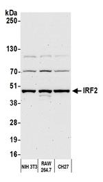 IRF2 Polyclonal Antibody