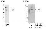 GR Polyclonal Antibody