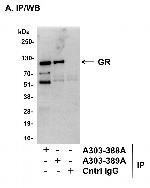 GR Polyclonal Antibody