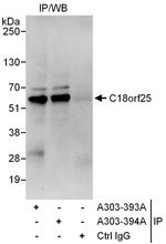 C18orf25 Antibody in Immunoprecipitation (IP)