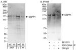 CSPP1 Polyclonal Antibody
