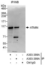 ATMIN Polyclonal Antibody