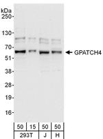 GPATCH4 Antibody in Western Blot (WB)