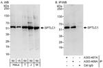 SPTLC1 Polyclonal Antibody