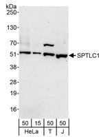 SPTLC1 Polyclonal Antibody