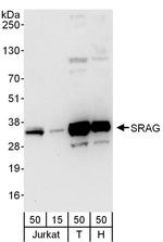 SRAG Polyclonal Antibody
