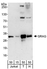 SRAG Polyclonal Antibody