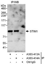STIM1 Antibody in Immunoprecipitation (IP)