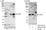 STIM1 Antibody in Western Blot (WB)
