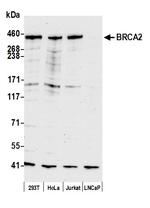 BRCA2 Polyclonal Antibody