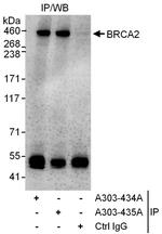 BRCA2 Polyclonal Antibody