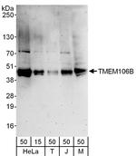 TMEM106B Polyclonal Antibody
