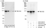 TBC1D2 Polyclonal Antibody