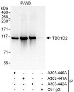 TBC1D2 Polyclonal Antibody