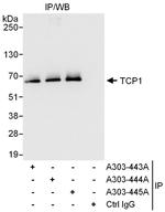 TCP1 Polyclonal Antibody