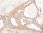 CCT8 Polyclonal Antibody