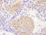 CCT8 Antibody in Immunohistochemistry (Paraffin) (IHC (P))