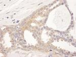 CCT8 Polyclonal Antibody