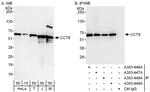 CCT8 Antibody in Western Blot (WB)