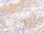 CCT8 Antibody in Immunohistochemistry (Paraffin) (IHC (P))