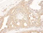 CCT8 Antibody in Immunohistochemistry (Paraffin) (IHC (P))