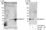 TMEM127 Polyclonal Antibody