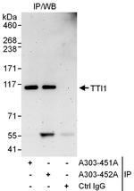 TTI1 Polyclonal Antibody