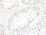 SNRNP200 Polyclonal Antibody