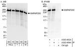 SNRNP200 Antibody in Western Blot (WB)