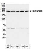 SNRNP200 Antibody in Western Blot (WB)