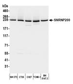 SNRNP200 Antibody in Western Blot (WB)