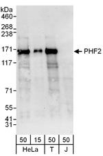 PHF2 Polyclonal Antibody