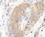 CCT3 Antibody in Immunohistochemistry (Paraffin) (IHC (P))
