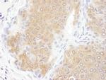 CCT3 Polyclonal Antibody